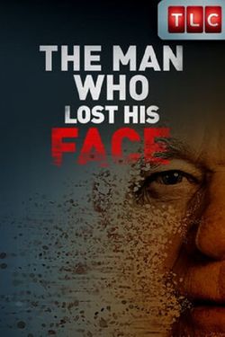 The Man Who Lost His Face