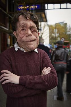 The Ugly Face of Disability Hate Crime