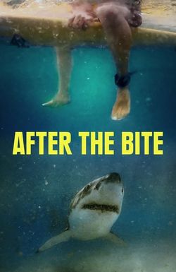 After the Bite