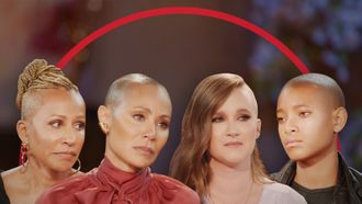 Episode 7 Alopecia: The Devastating Impact